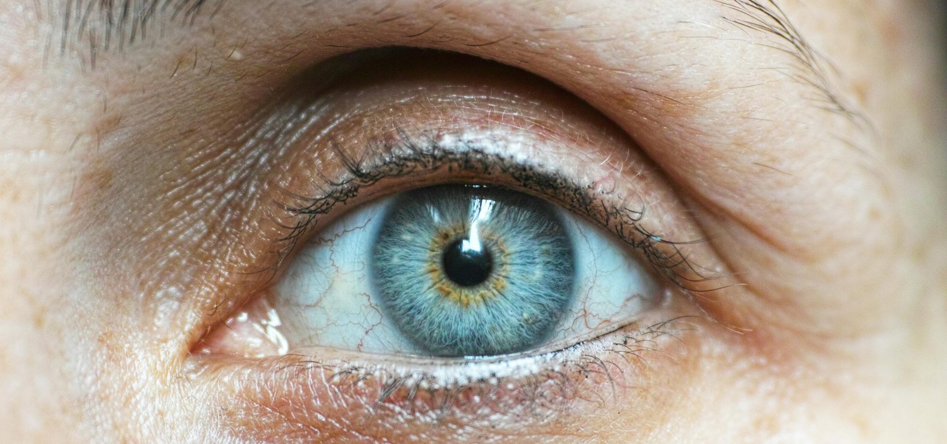 Vision Support